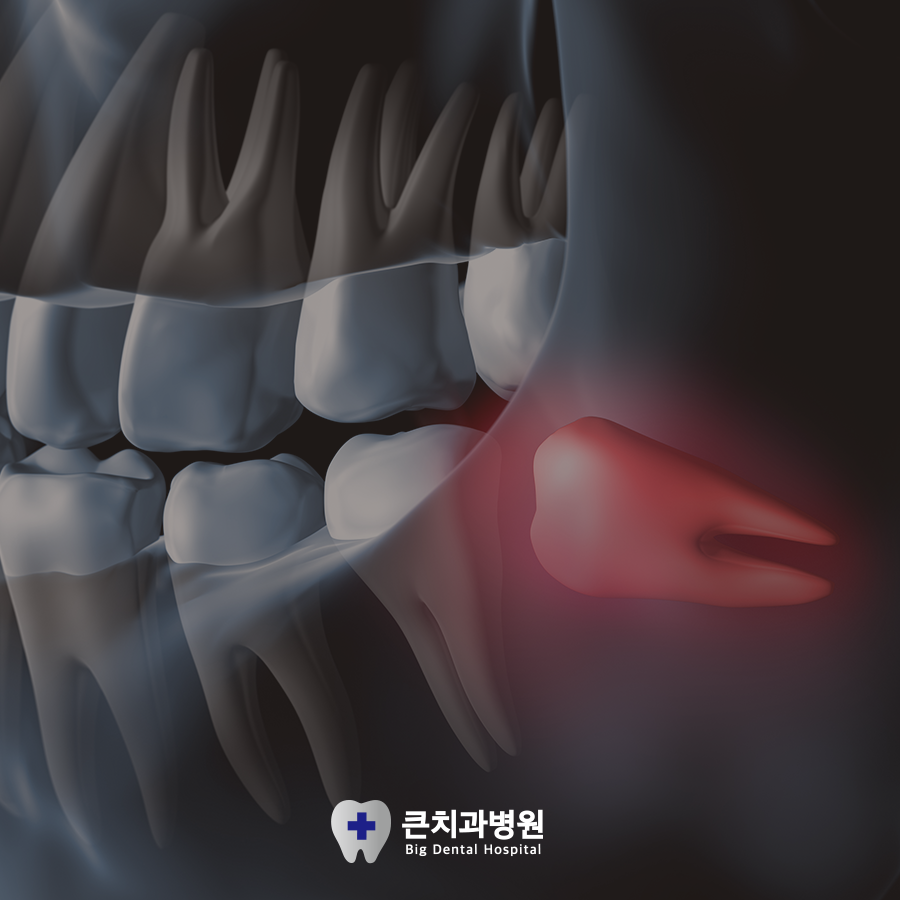 울산북구치과