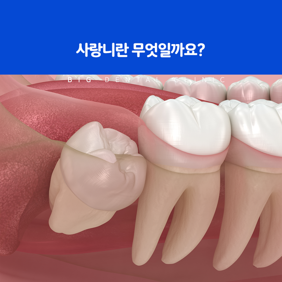 울산북구치과
