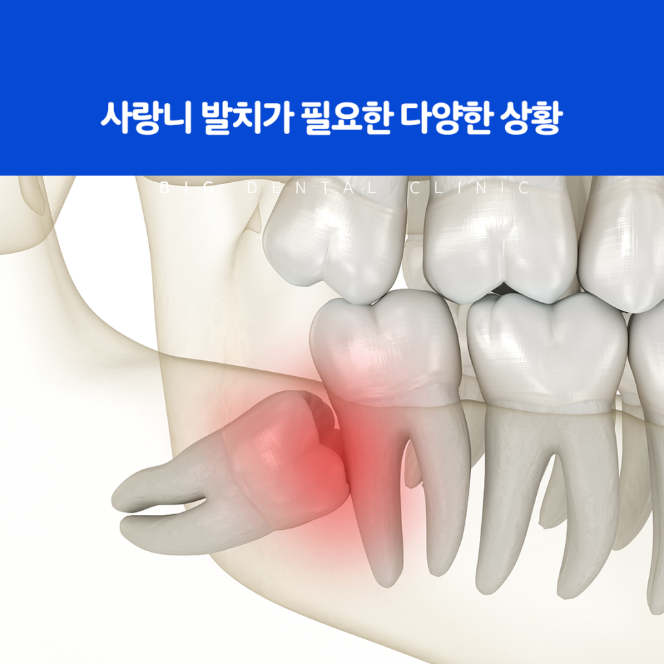 울산북구치과
