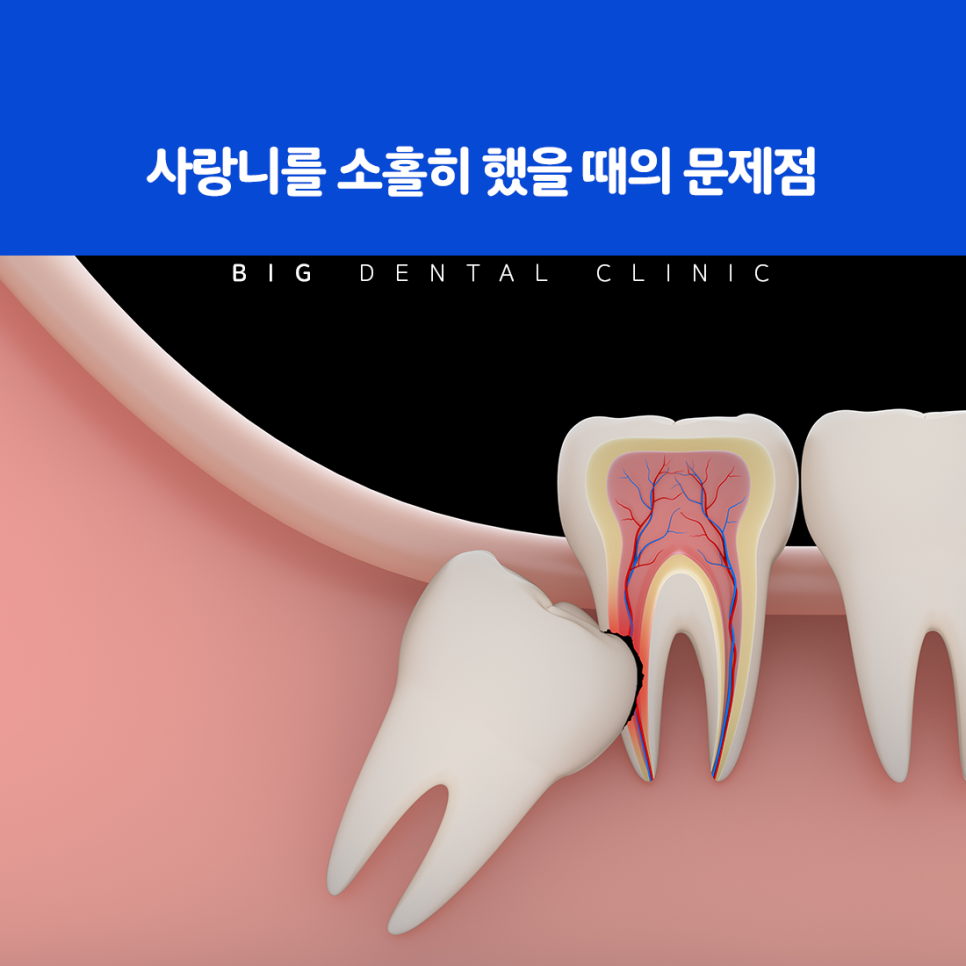 울산북구치과
