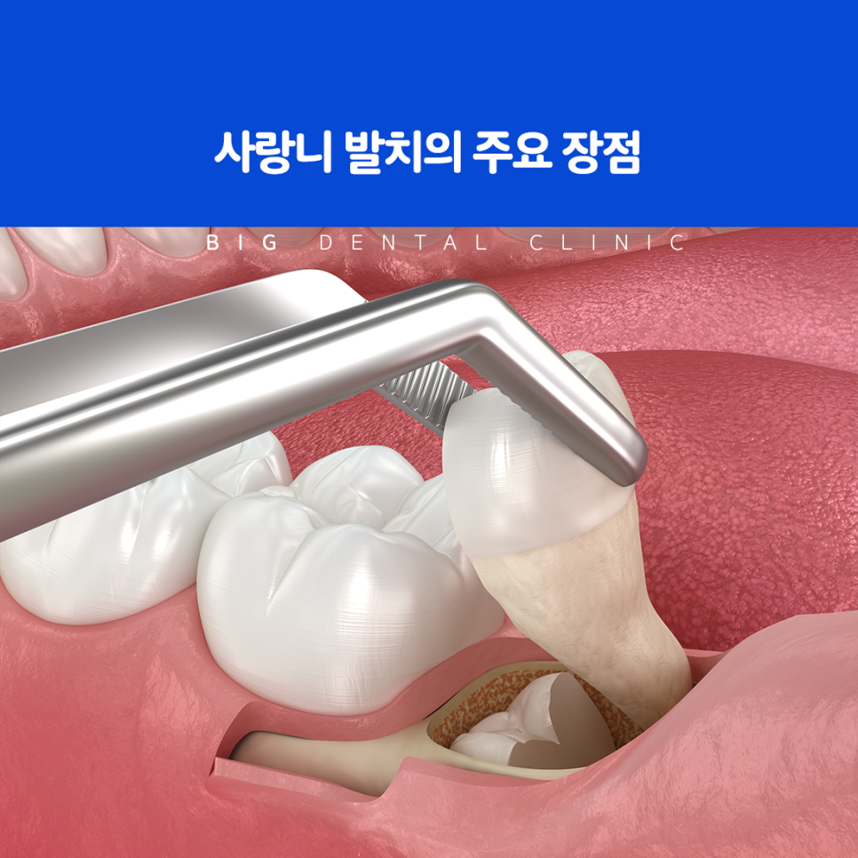 울산북구치과