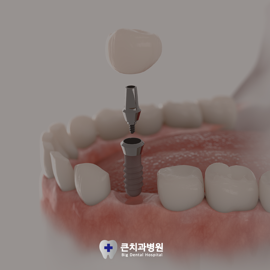 울산북구치과