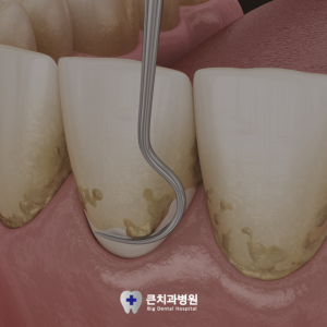 울산북구치과