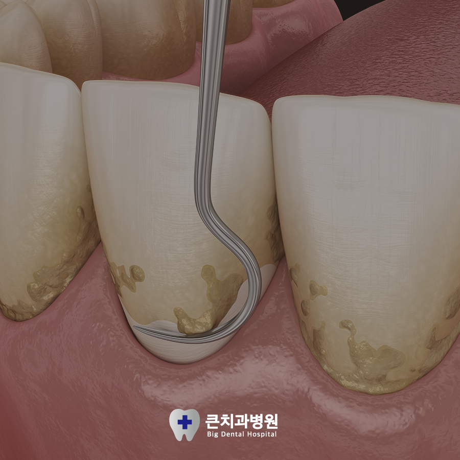 울산북구치과