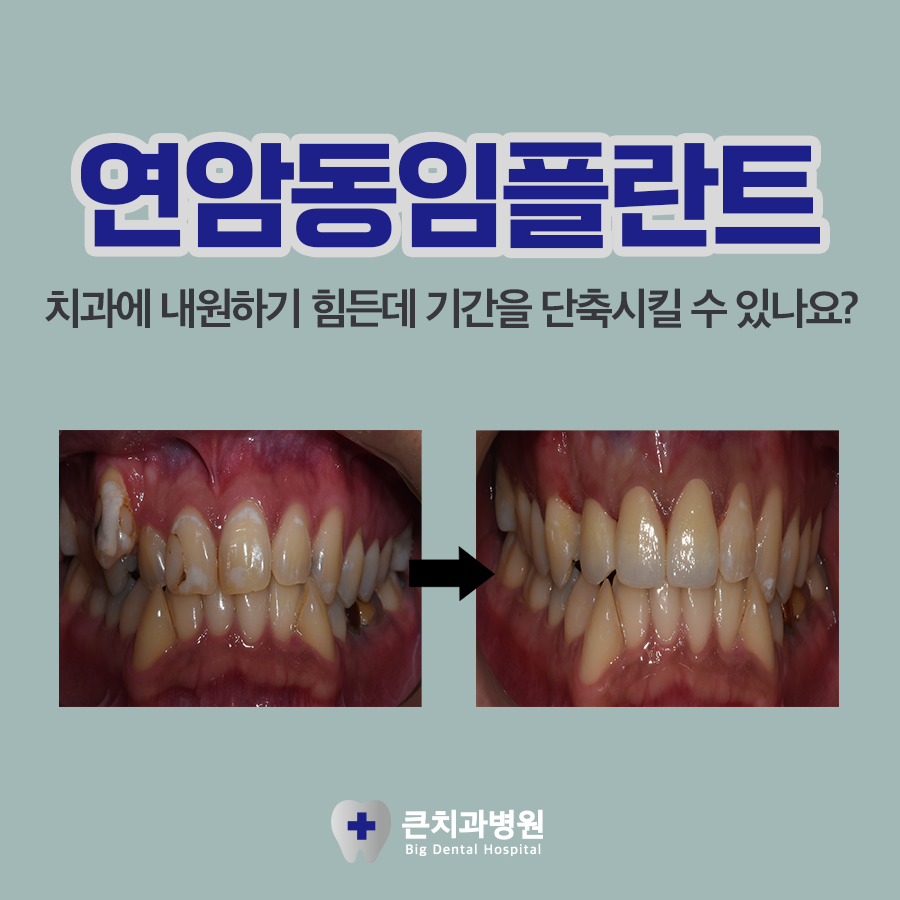 울산북구치과