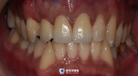 울산북구치과