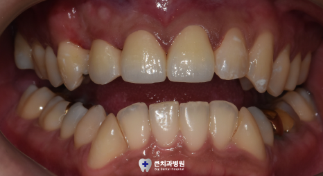 울산북구치과