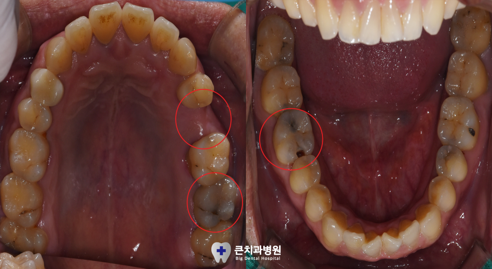 울산북구치과