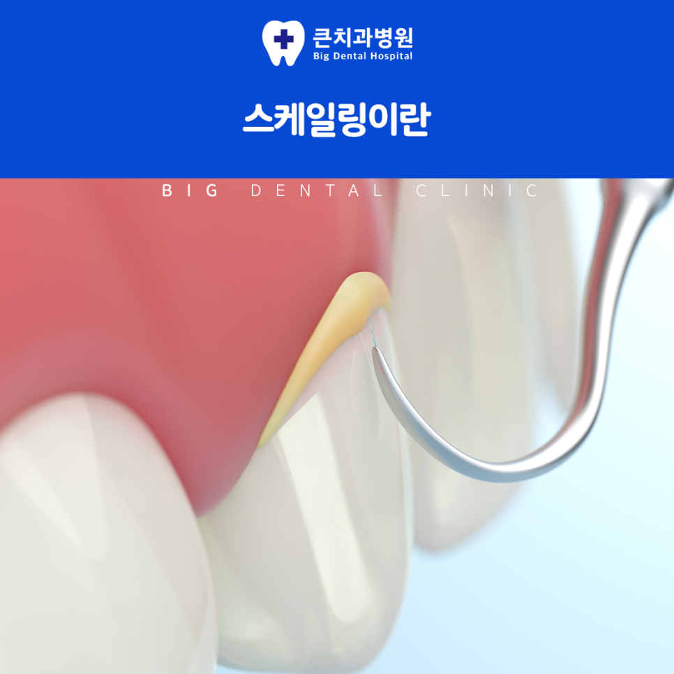 울산북구치과