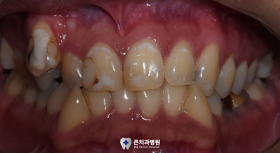 울산북구치과