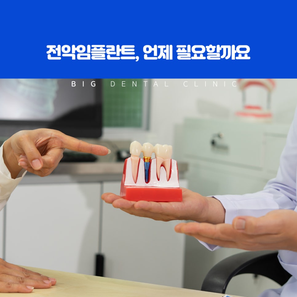 울산북구전악임플란트