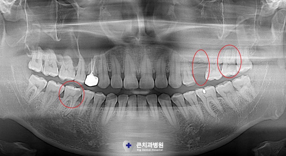 울산북구치과