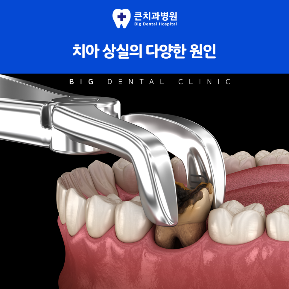 울산북구치과
