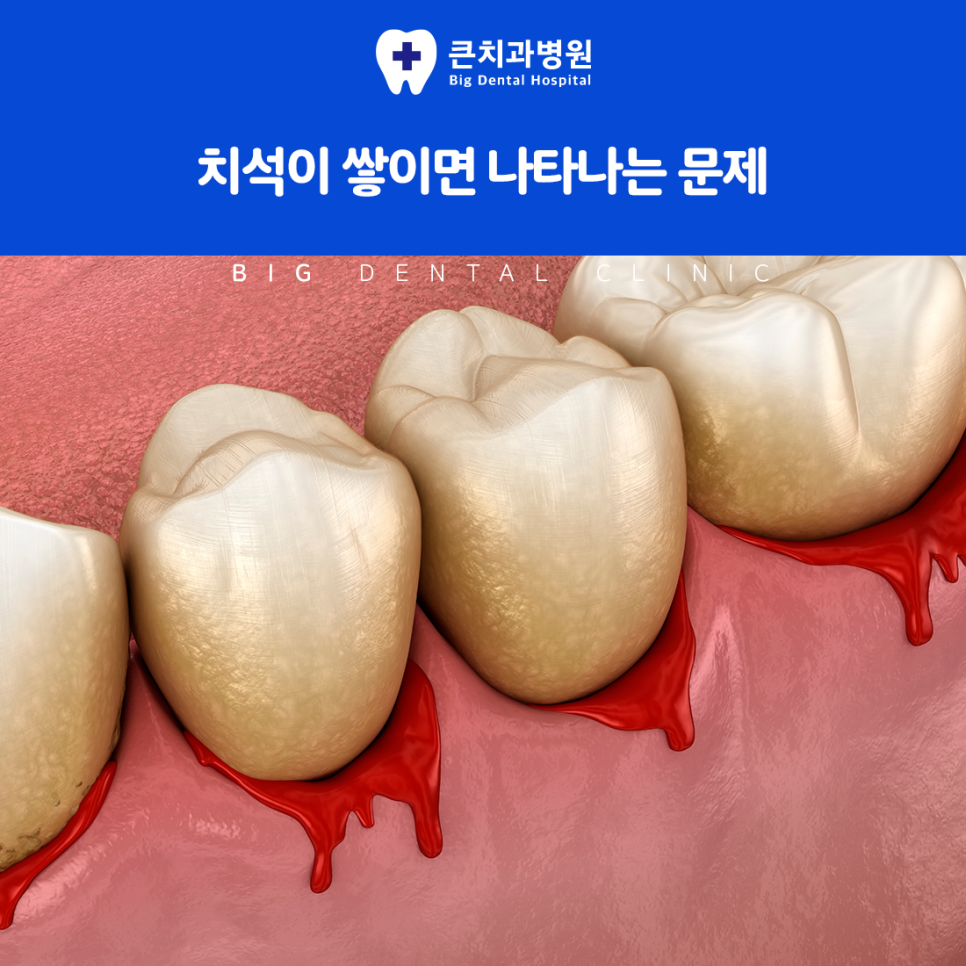 울산북구치과