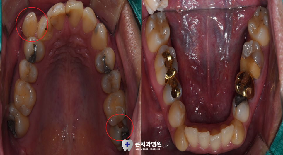 울산북구치과