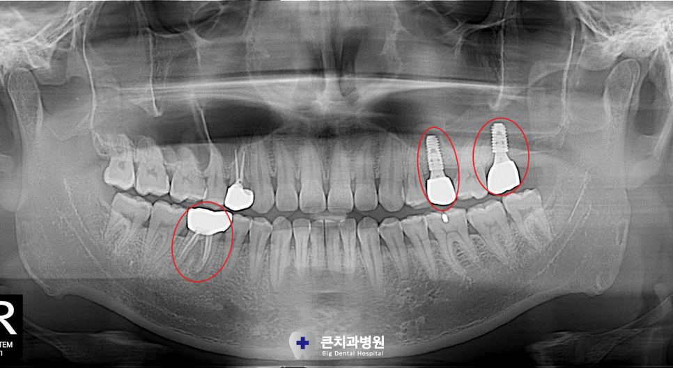 울산북구치과