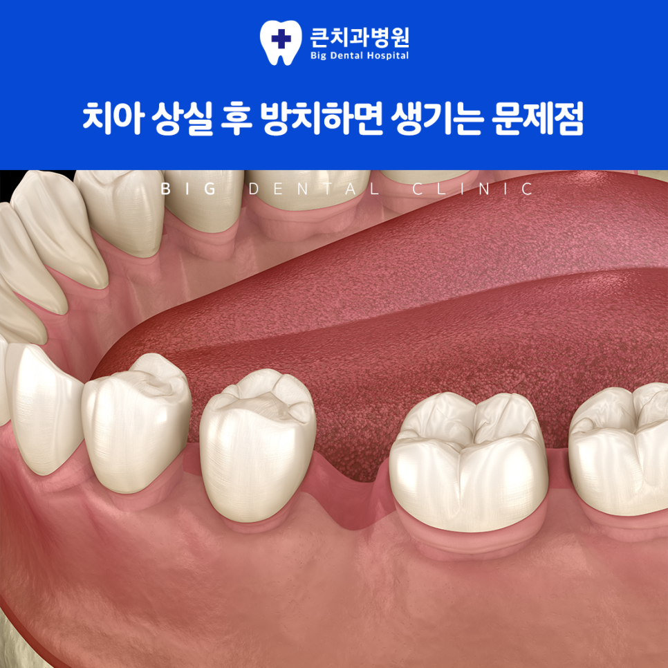 울산북구치과