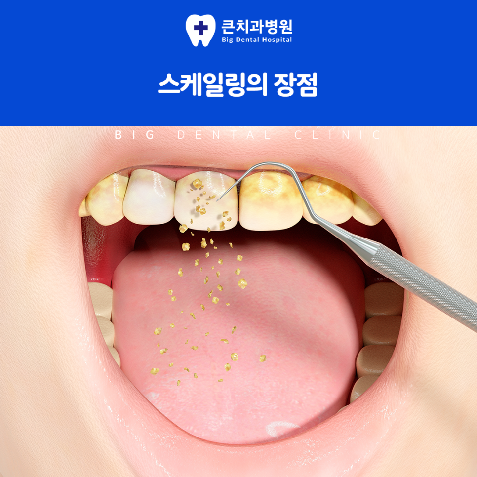 울산북구치과