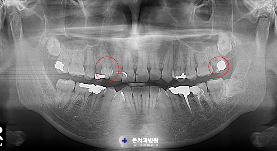 울산북구치과