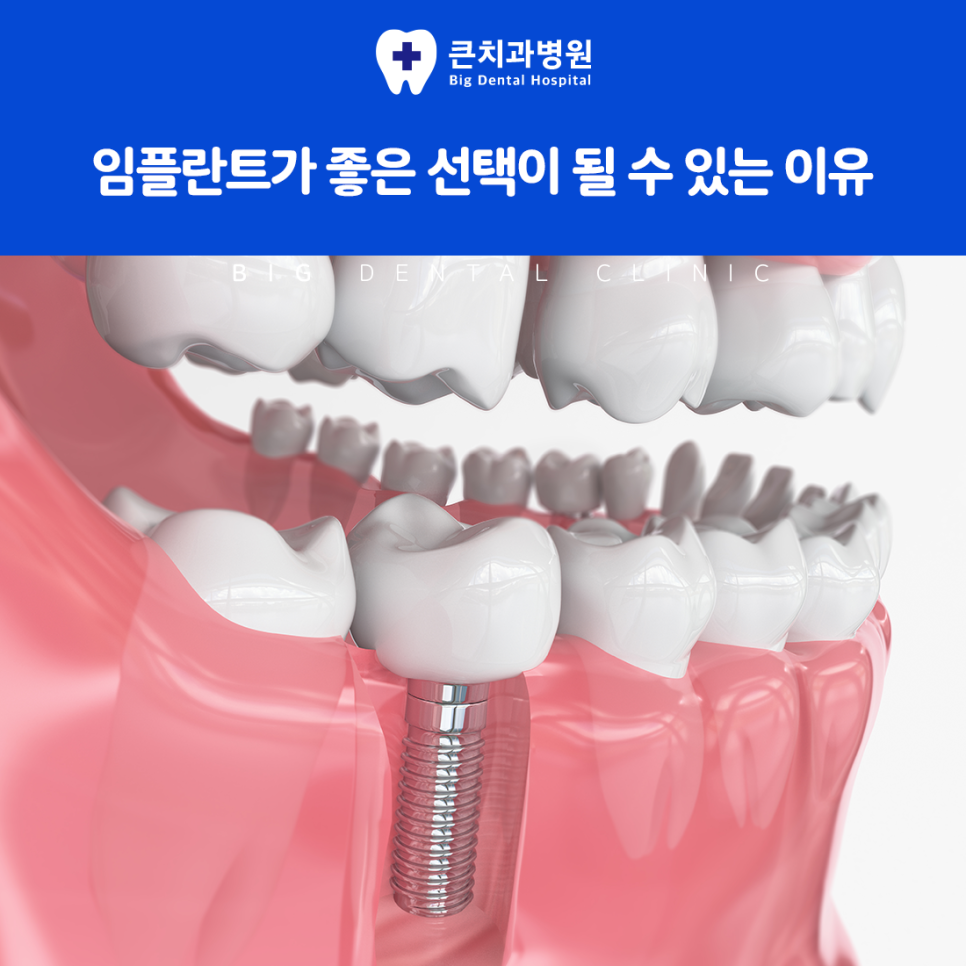 울산북구치과
