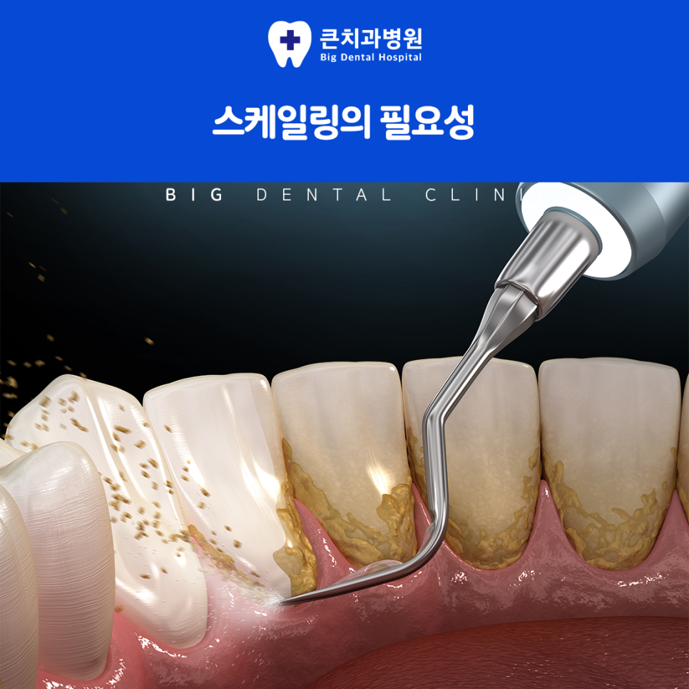 울산북구치과