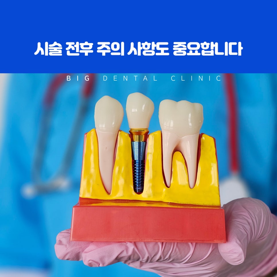 울산북구전악임플란트