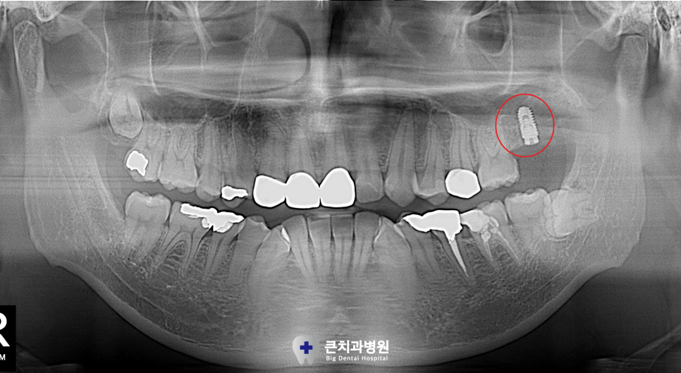 울산북구치과