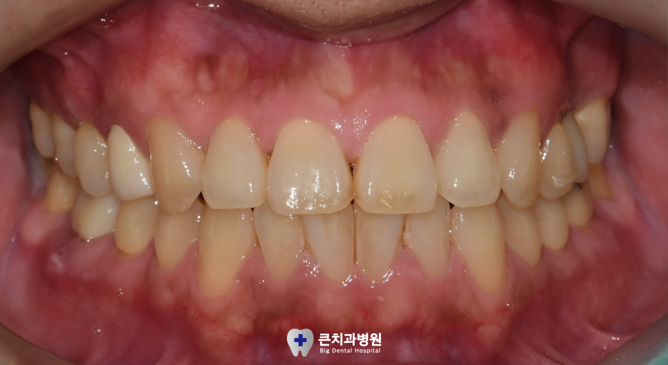 울산북구치과