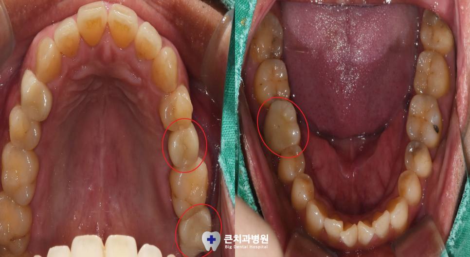 울산북구치과