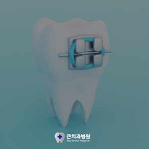 울산북구교정치과