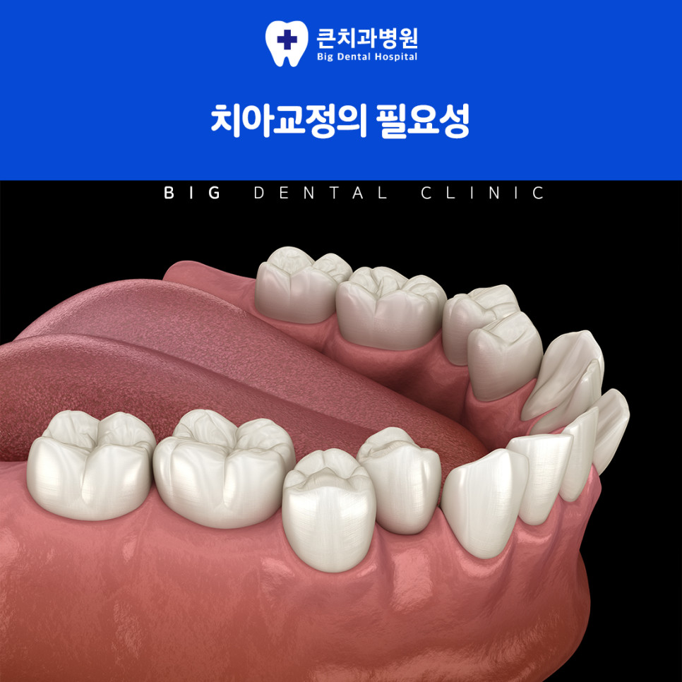 울산북구치과추천
