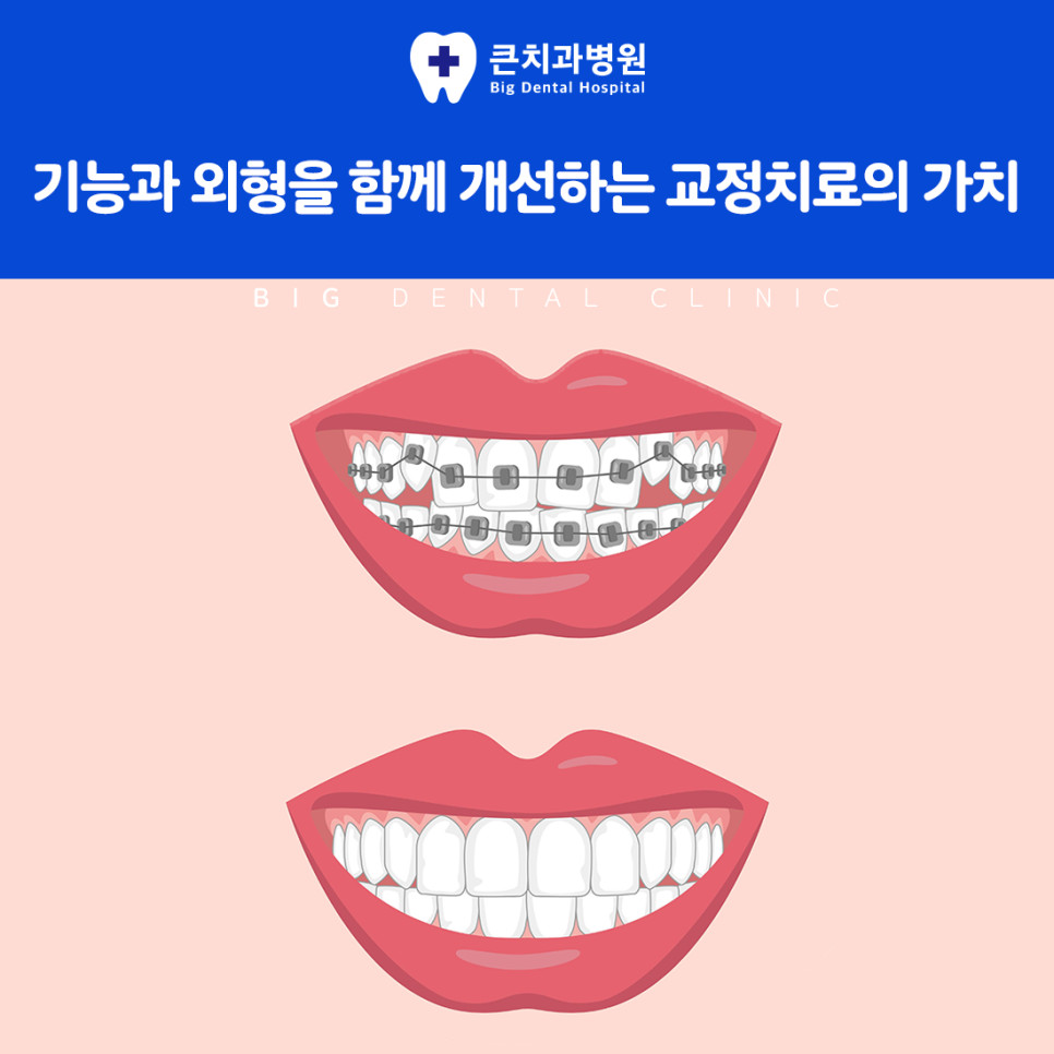 울산북구치과추천