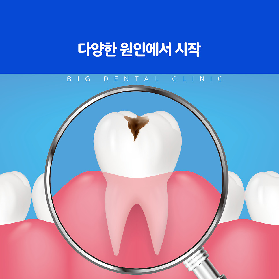 울산북구충치치료