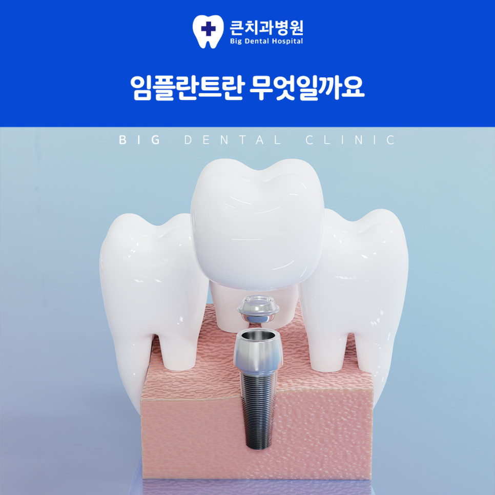 울산북구치과 자연 치아 상실 후 저작 기능 저하와 구강 건강 영향 및 신중한 진단 필요성