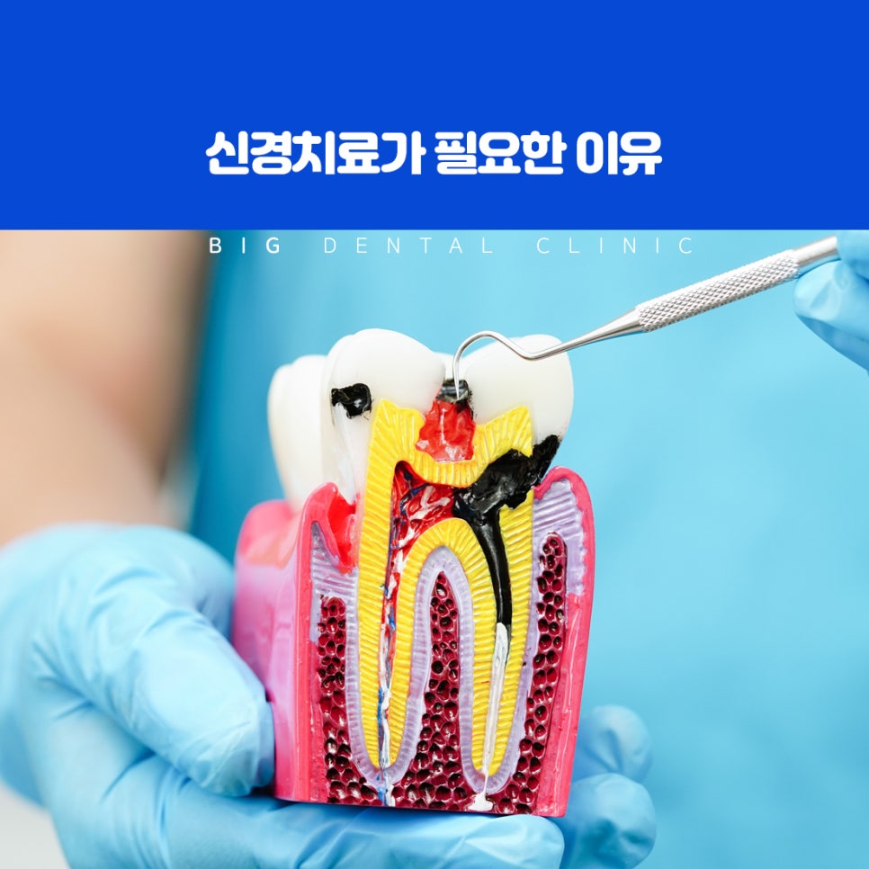 울산북구신경치료 바쁜 일정과 두려움으로 악화되는 통증 기준