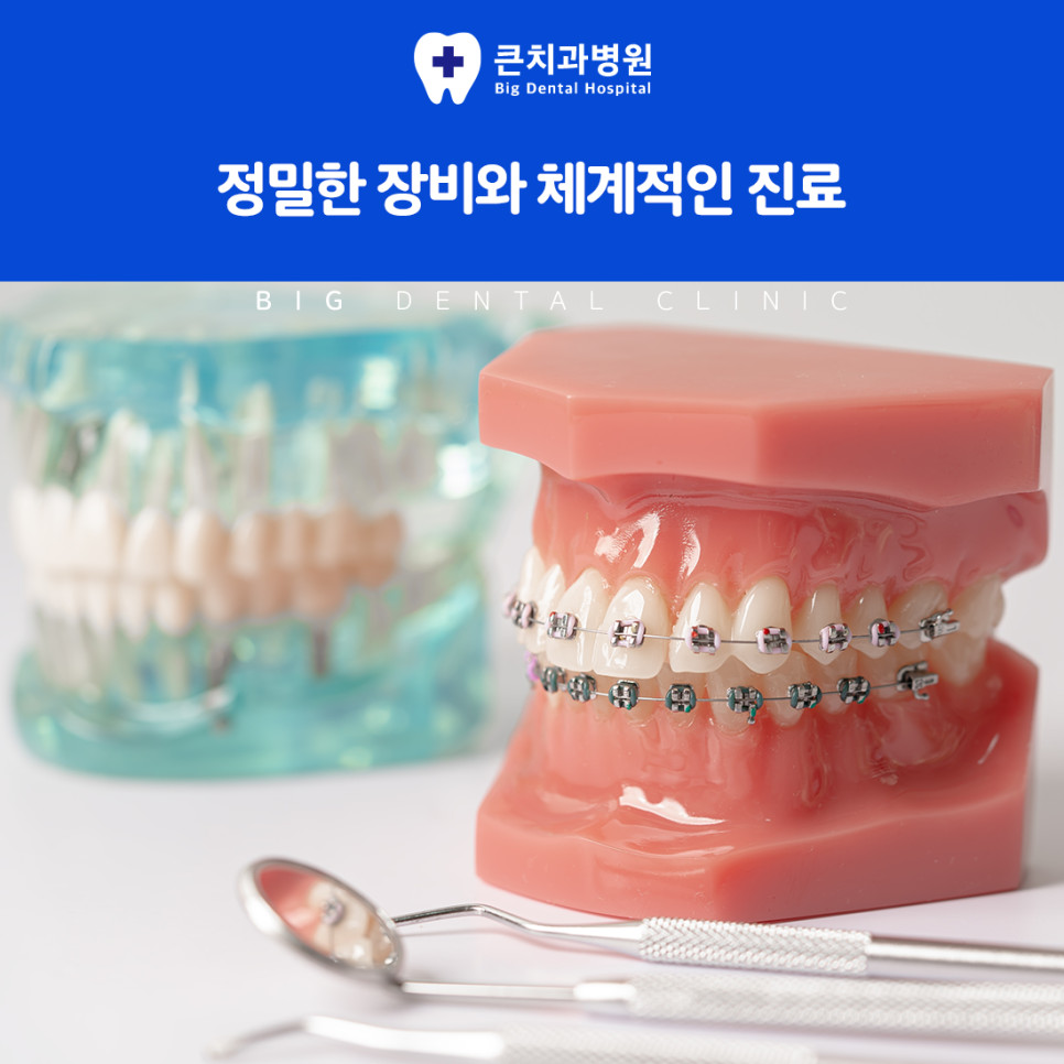 울산북구치과 앞니 벌어짐과 겹침 교정 필요 기준