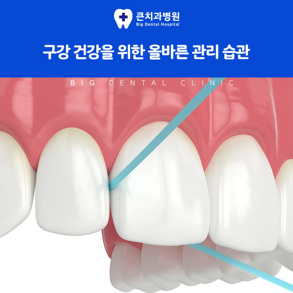 울산북구스케일링 치석이 잇몸과 치아 사이 염증과 치주 질환으로 번지는 주의사항