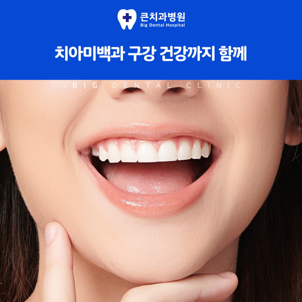 울산북구치과 치아미백 효과 겉면 착색과 내부 색 고려한 밝기 완성