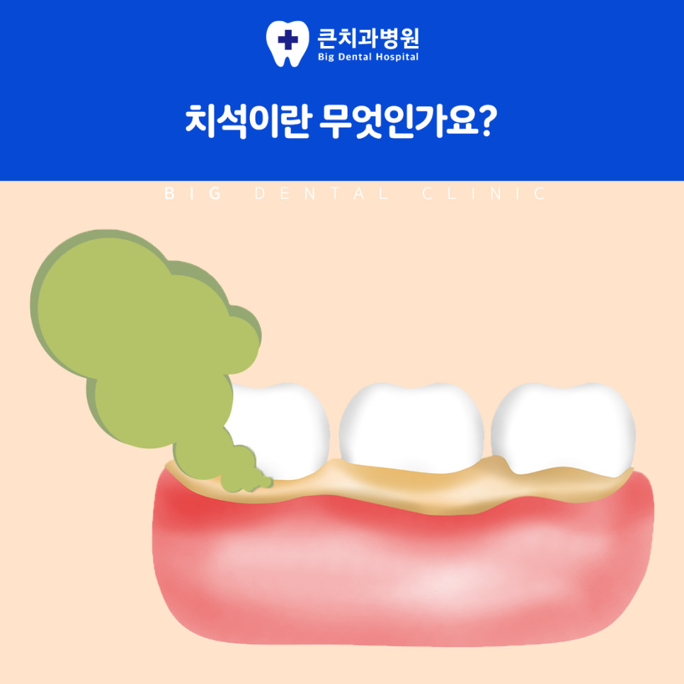울산북구치과