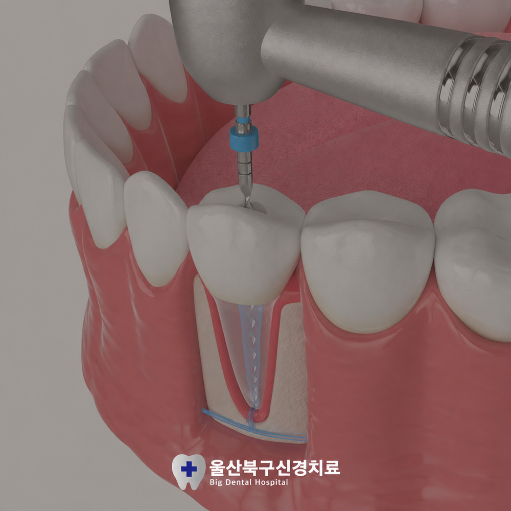 울산북구신경치료 갑작스러운 치아 통증과 진료 미루기 주의사항
