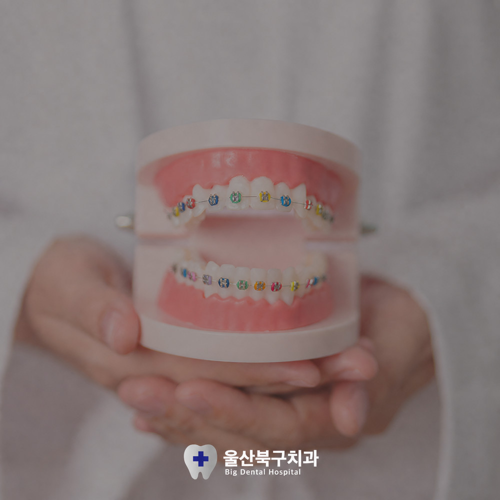 울산북구치과 치아교정 전 미소와 치열 위생 관리 필요성