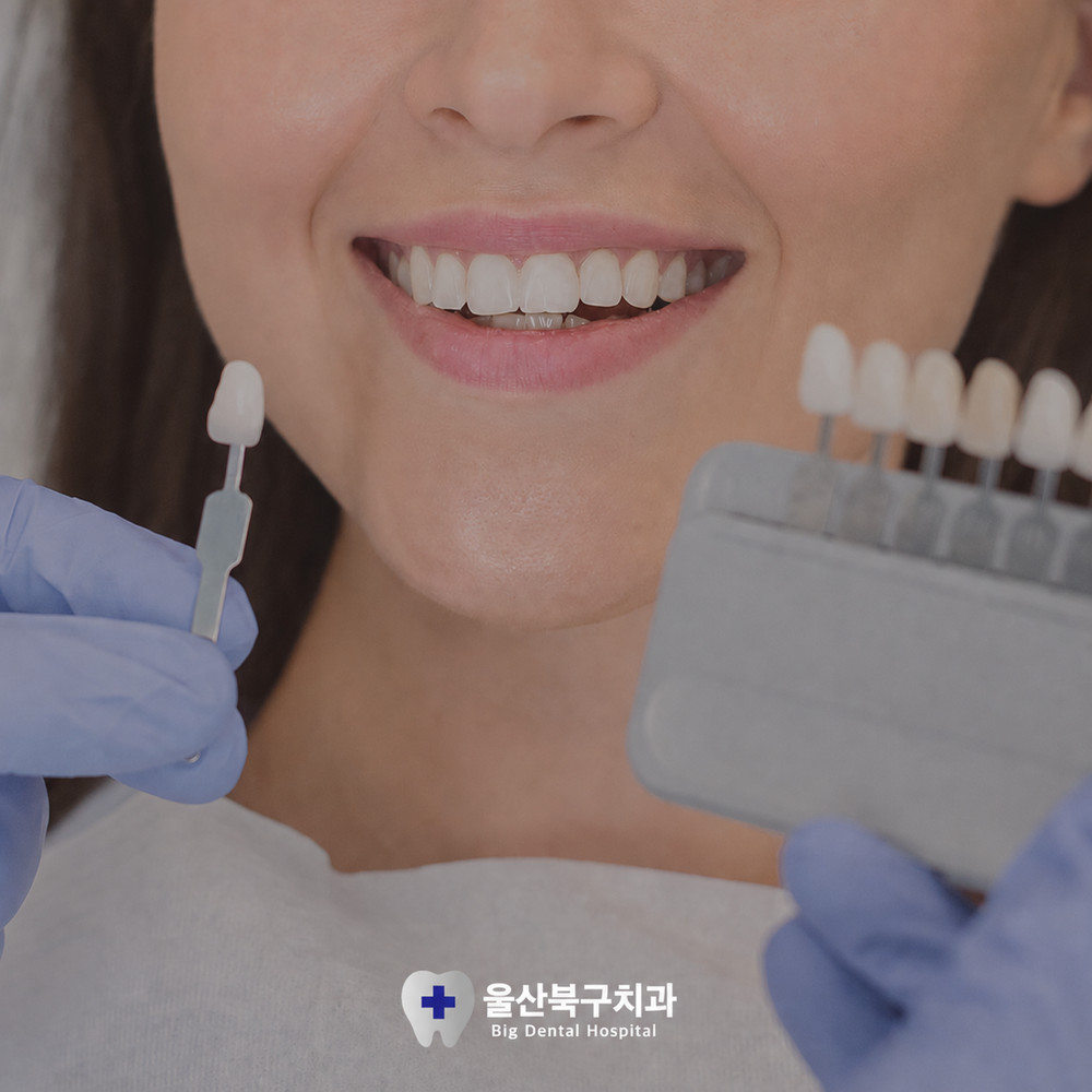 울산북구치과 치아미백 전 구강관리 습관과 첫인상 관계 형성 영향