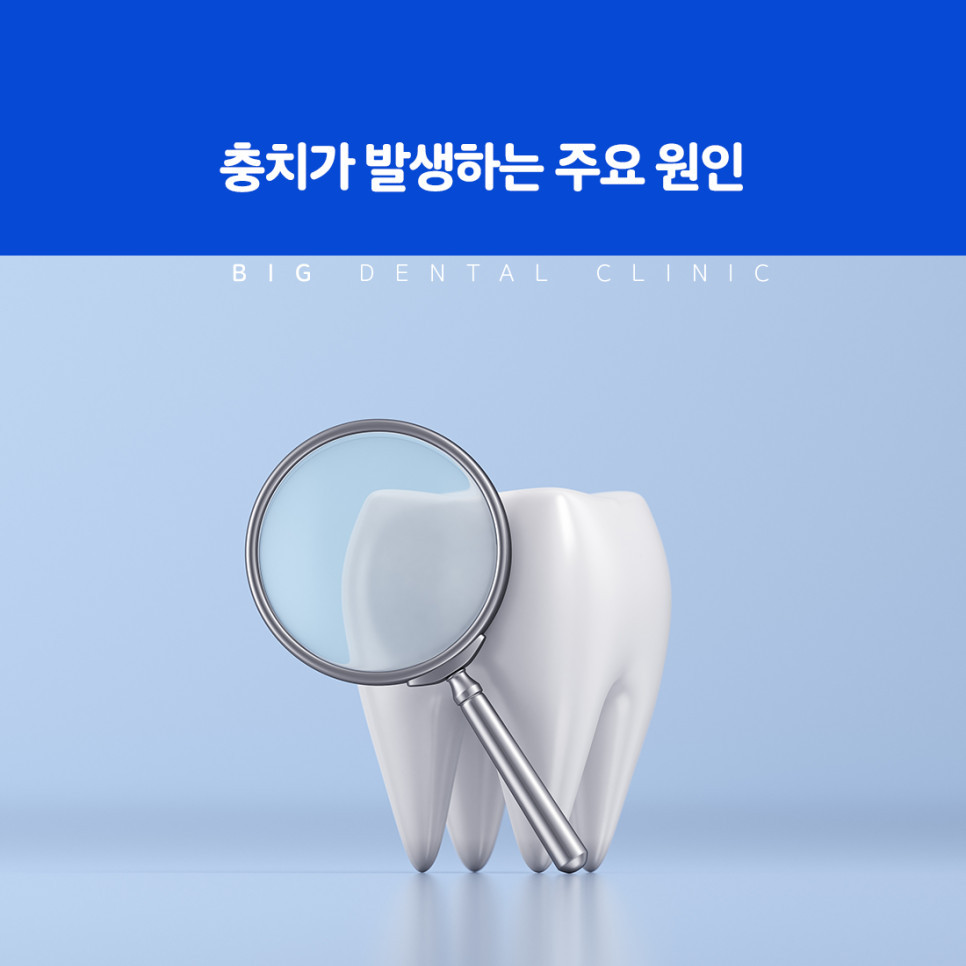 충치치료 방법과 수복 과정 설명 이미지