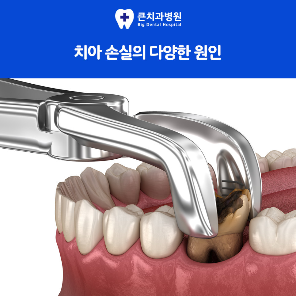 울산북구치과