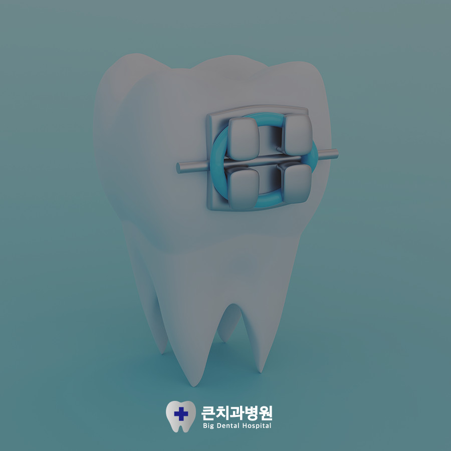 치아교정 진단 이미지