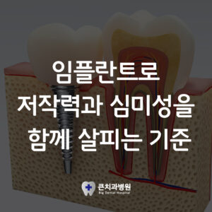 울산북구치과잘하는곳