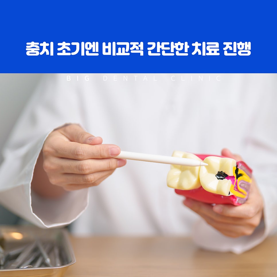 울산북구치과야간진료 충치치료 관심 생긴 순간 가장 좋은 시작 시기 판단 기준
