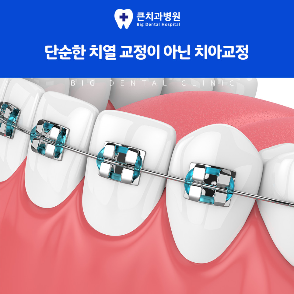 울산북구치과 치아교정 필요성 잇몸과 치아 균형 저하로 생기는 일상 불편 주의사항