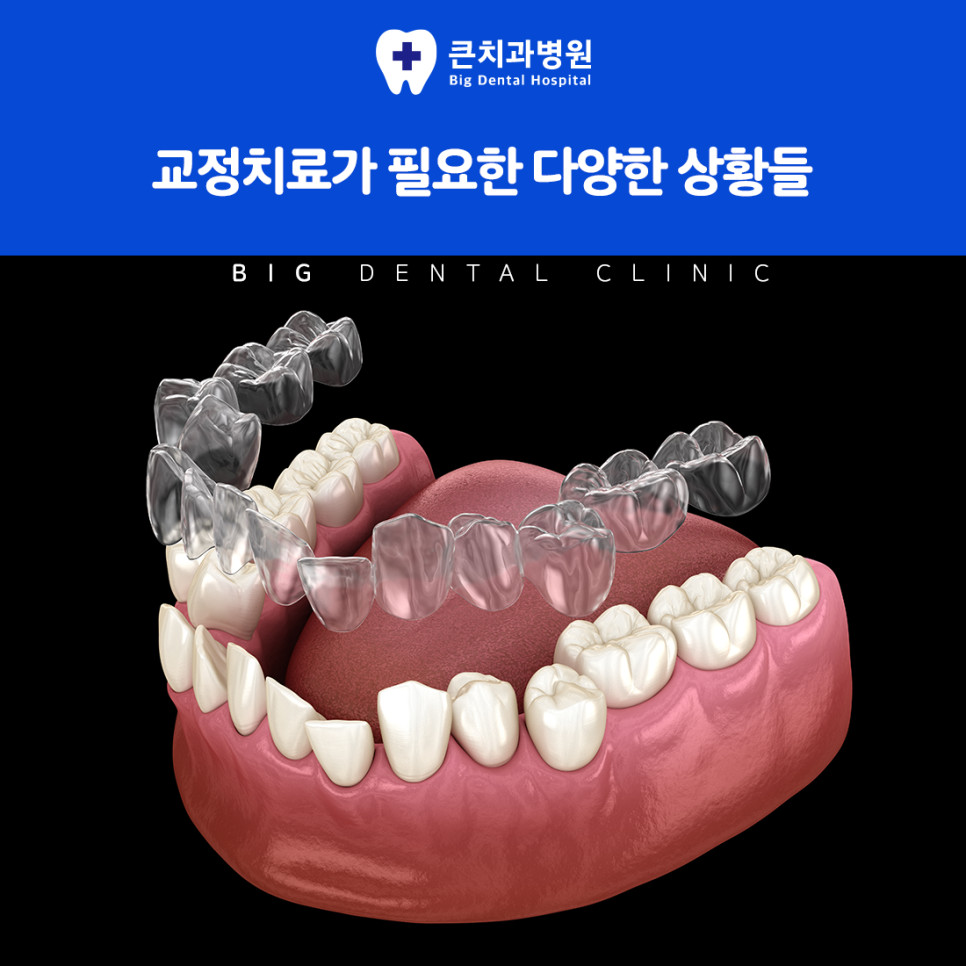 울산북구치과 치아교정 방법 입술 라인 턱 위치 씹는 힘 발음 변화 확인 기준