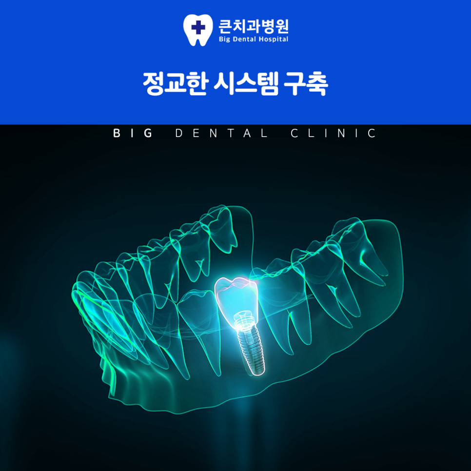 울산북구치과잘하는곳 오래된 보철물 불편 시 임플란트 재치료 고려 방법과 기준